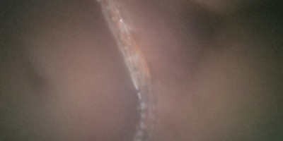 Ass fucking double penetration fuck addict